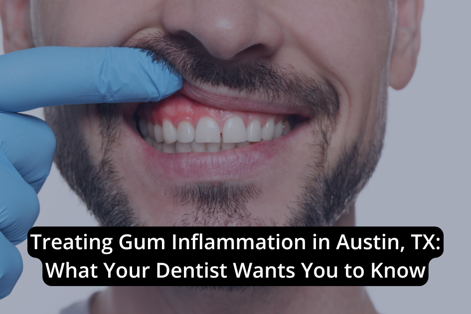 A person wearing a blue glove lifts their upper lip to reveal inflamed gums, with a headline about seeing a dentist for gum inflammation in Austin, TX.