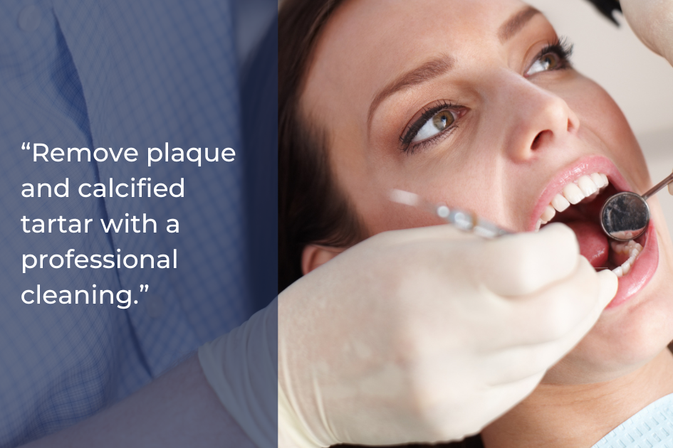 A dental professional uses instruments to clean a patient’s teeth, with text advising removal of plaque and calcified tartar through regular dental cleanings as part of your smile game plan.